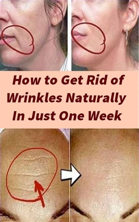 How to Get Rid of Wrinkles Naturally In Just One Week - medicine health life