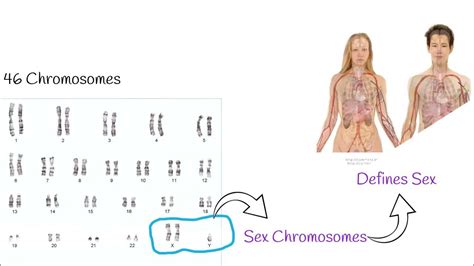 Klinefelter syndrome signs, symptoms and treatment, Klinefelter ...