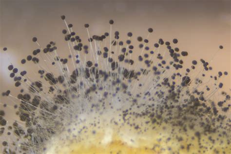 Mold Spores on Bread – Rhizopus under the microscope – Molekule Blog