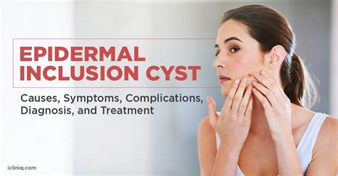 Inclusion Cyst Treatment