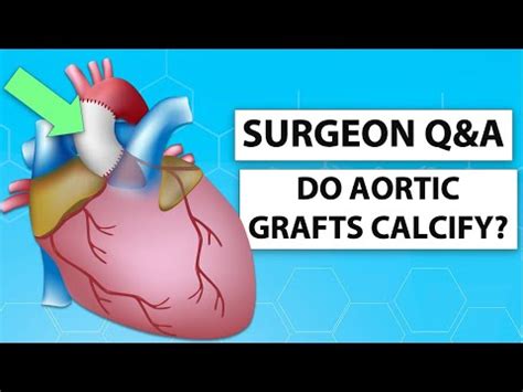 Can Dacron Aortic Aneurysm Grafts Calcify?