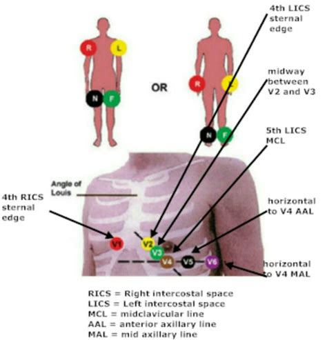 12 Lead ECG Electrode Placement