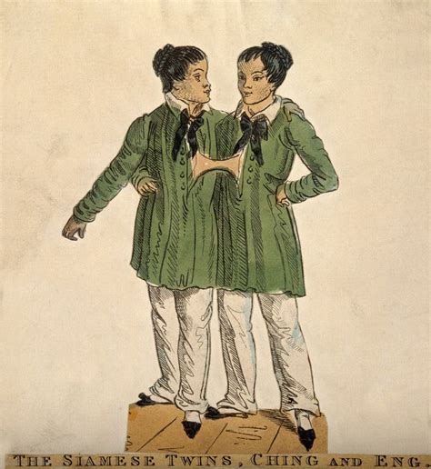 Chang and Eng the Siamese twins. Coloured etching. | Wellcome Collection