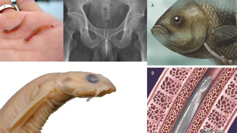 Candirú un pez parásito que se introduce por orificios genitales o ...