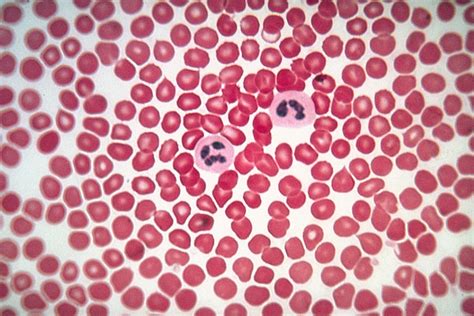 Lm Of Human Blood Smear Showing Red & White Cells Photograph by Eric Grave - Fine Art America