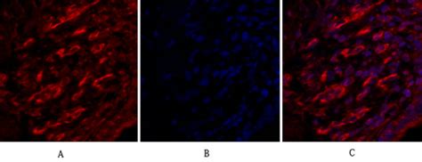 Claudin-5 Polyclonal Antibody - WB, IHC-P, IF - Buy Now!