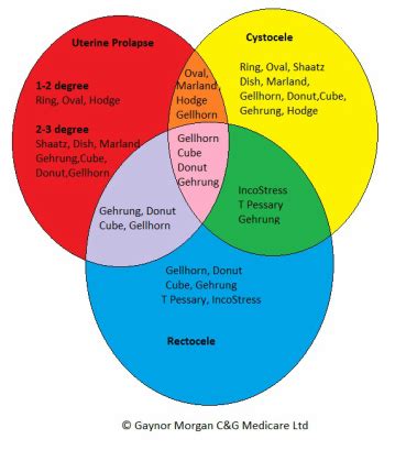 Pessary types - YOUR PESSARY