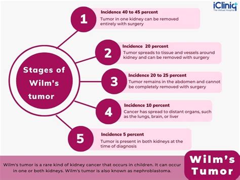 Understanding The Diagnosis And Treatment Of Wilms’ Tumor - Ask The Nurse Expert