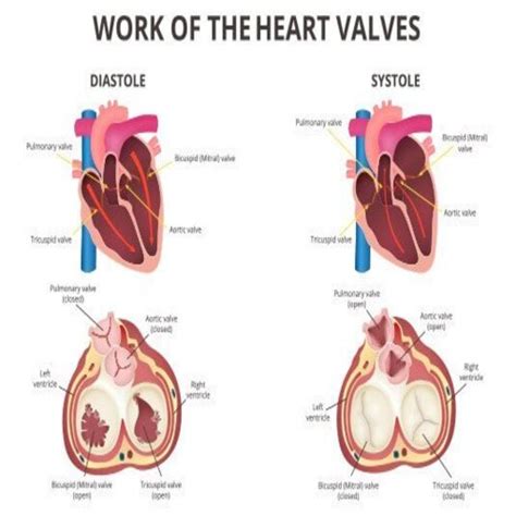 HEART VALVE REPLACEMENT | MedInivo