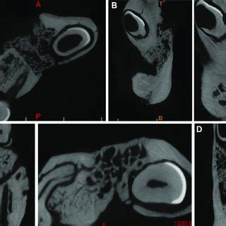 Micro-CT morphometric parameters of the bone regenerate in 3-D analysis. | Download Table