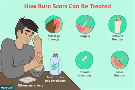 How Burn Scars Are Treated