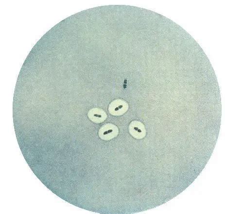 Quellung reaction: Principle, Procedure, Results • Microbe Online