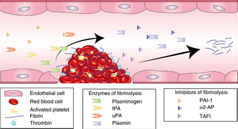 Hemorrhagic disorders of fibrinolysis: a clinical review - Saes - 2018 - Journal of Thrombosis ...