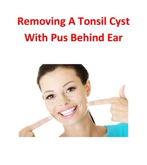 Removing a tonsil cyst with pus behind ear