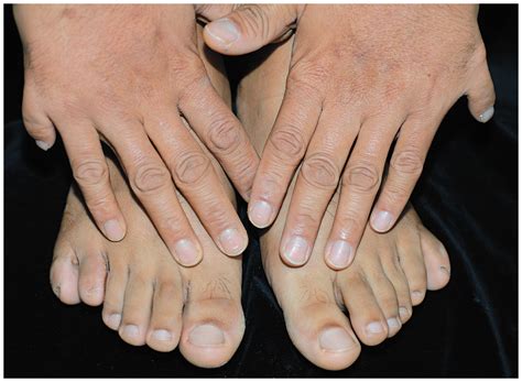 Amazing Facts.: ‎1 out of 500 humans are born with extra fingers or toes.