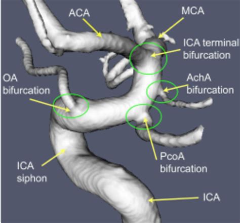 Internal Carotid Artery