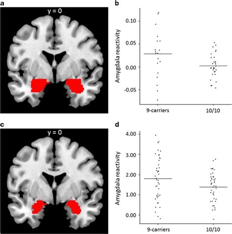 Association between amygdala reactivity and a dopamine transporter gene polymorphism ...