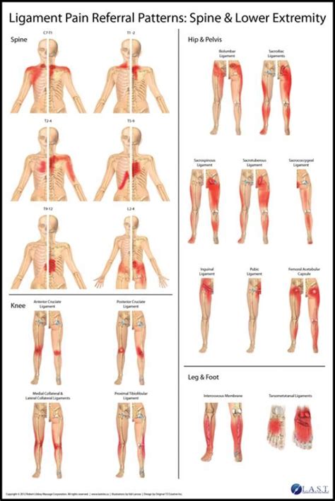 Psoas Pain Referral Pattern - Pattern.rjuuc.edu.np