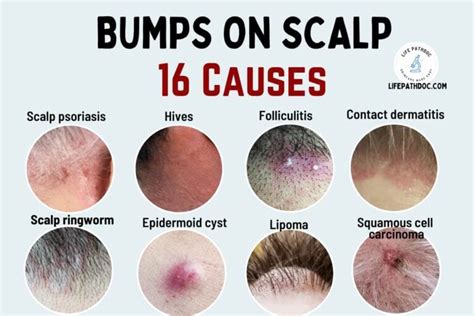 Bumps on the Scalp: 16 Causes, Pictures, and Treatment