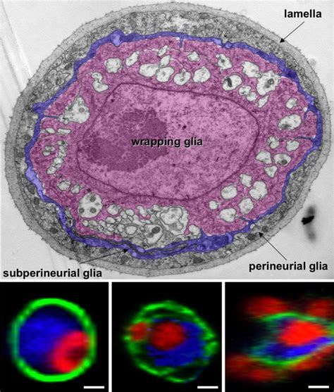 Blood-brain barrier | Klaembt Lab