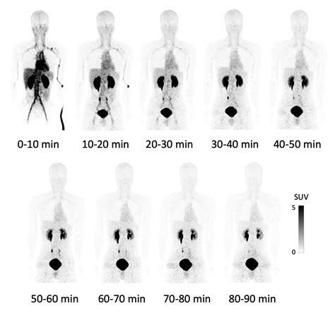 Safety of novel cancer-specific PET probe confirmed in clinical research