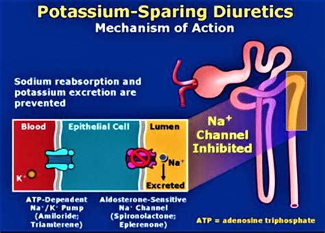 Potassium sparing diuretics drugs list, mechanism of action & side effects