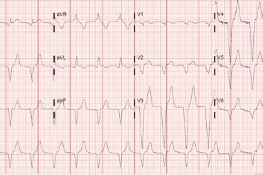 Sudden-Onset Substernal Chest Pain Archives - Journal of Urgent Care ...