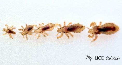 What Lice Look Like: Pictures of Lice (Color, Size, and More)