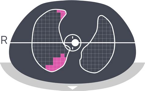 Electrical Impedance Tomography (EIT) Device - LuMonTM | Sentec