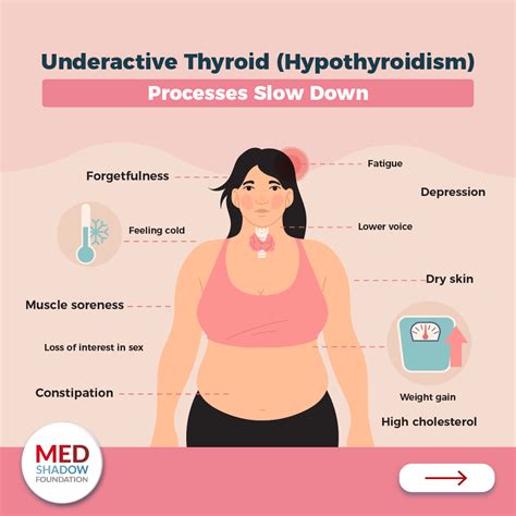 Thyroid Problems: Symptoms, Treatments and Side Effects - MedShadow ...