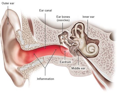 Outer ear infection | informedhealth.org