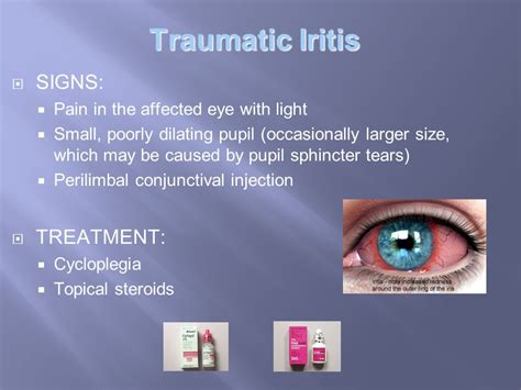 Traumatic Iritis Slit Lamp