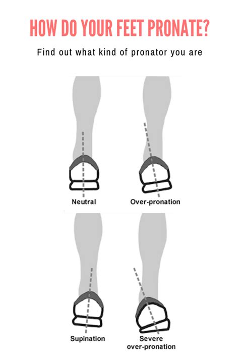 What is Pronation and Finding Your Foot Type - HubPages