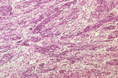 Uterus Histology - Myometrium - histology slide