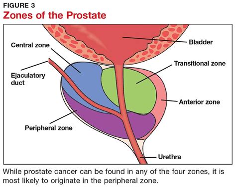 Screening for Prostate Cancer in Black Men | Clinician Reviews