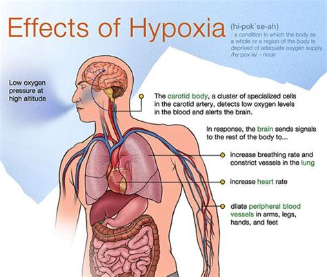 Cyanosis, Hypoxia types, causes, symptoms and Effectiveness of O2 therapy in treatment of ...