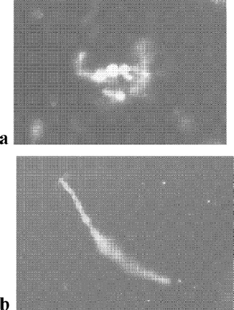 Direct microscopy examination of CF patient sputum samples that were... | Download Scientific ...