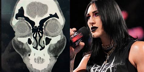 Rhea Ripley Sidelined with Orbital Fracture After Brutal NXT Segment