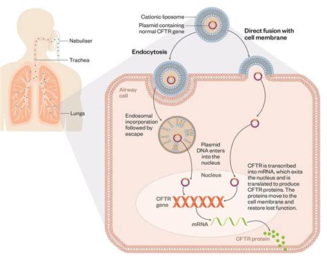 Developing gene therapy to treat cystic fibrosis: challenges and ...