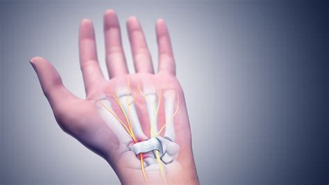 Carpal Tunnel Syndrome (CTS): Cause, Pathophysiology and Treatments