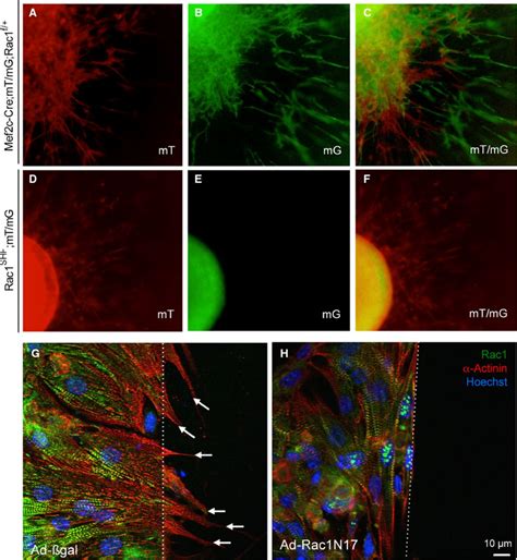 Rac1 deficiency results in defective cell migration and lamellipodia... | Download Scientific ...