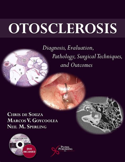 Otosclerosis: Diagnosis, Evaluation, Pathology, Surgical Techniques, and Outcomes – Surgery Books