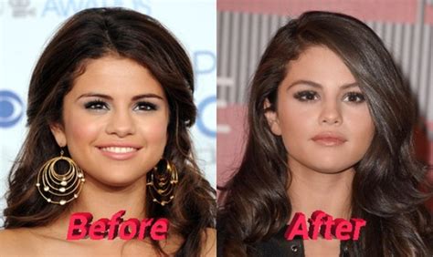 Selena Gomez Plastic Surgery or Special Make up? Really?