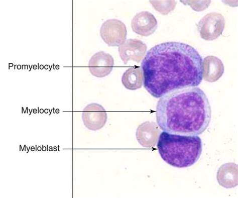 60 best Hematology :) images on Pinterest | Medical laboratory science, Science and Chemistry jokes