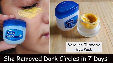 She Removed Dark Circles & Eye WRINKLES in 7 Days - Vaseline Turmeric Eye Pack | No Under Eye ...