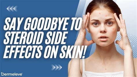 Dermeleve: Say Goodbye to Steroid Side Effects on Skin - Choose the ...