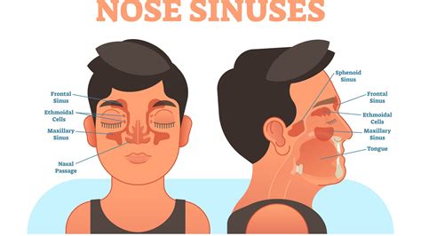 Sinus Sale, 57% OFF | www.newman.nsw.edu.au