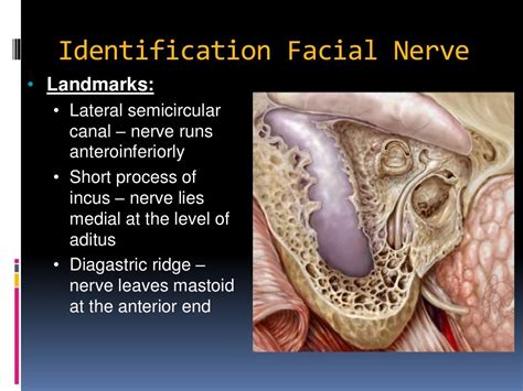 Cortical mastoidectomy