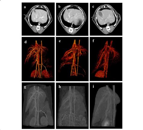 Triple-phase hepatic CT images of the delay phase at different TDs (60... | Download Scientific ...