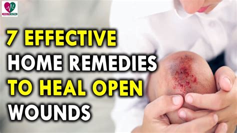 Home Remedies to Heal Open Wounds - Best Health Tips for Men and Womens - YouTube